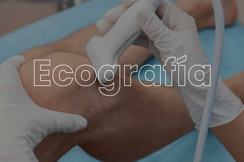 Ecografía-fisioterapia