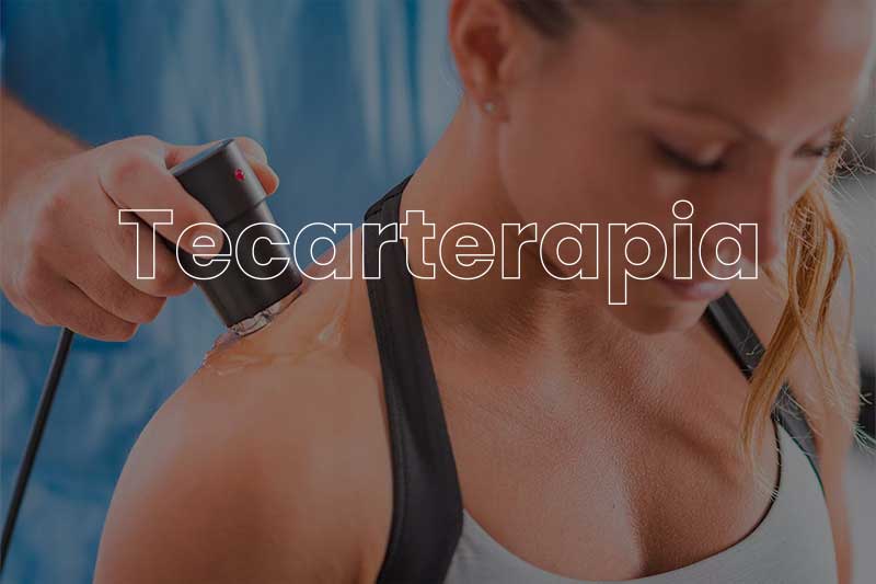 Tecarterapia-diatermia-fisioterapia