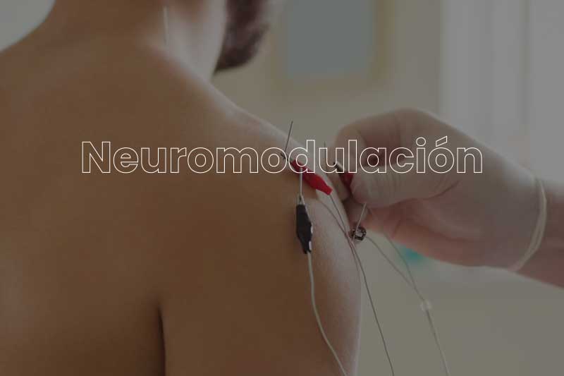 neuromodulación-fisioterapia